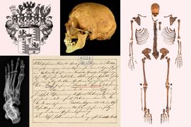Osteobiografie a paleopatologie ostatků hraběcího rodu Swéerts-Sporck v kontextu dobových písemných pramenů